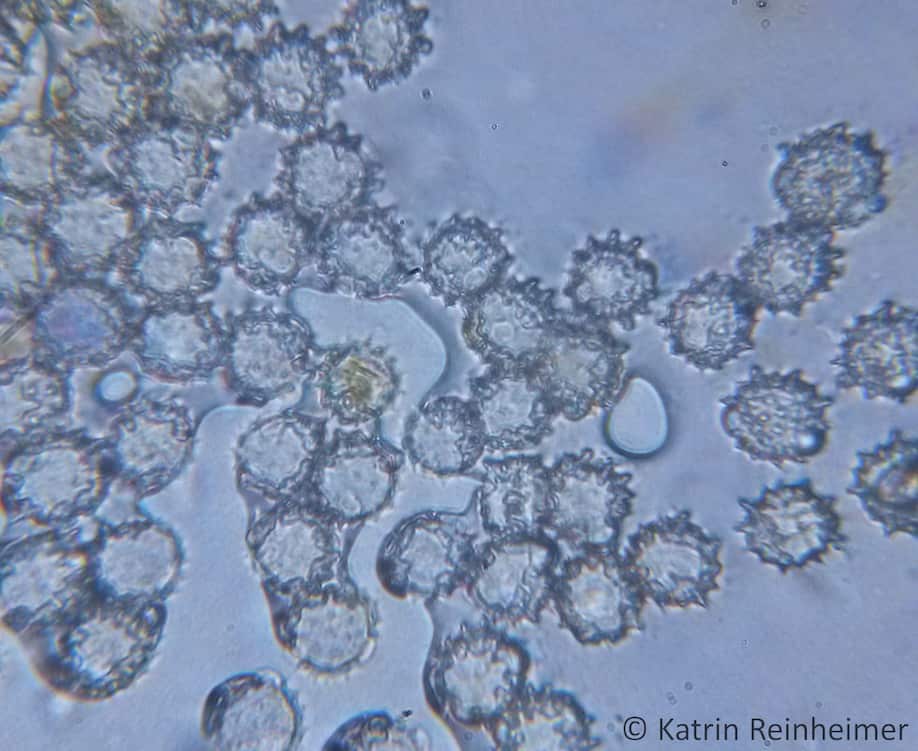 Gänseblümchen-Pollen unter dem Mikroskop.