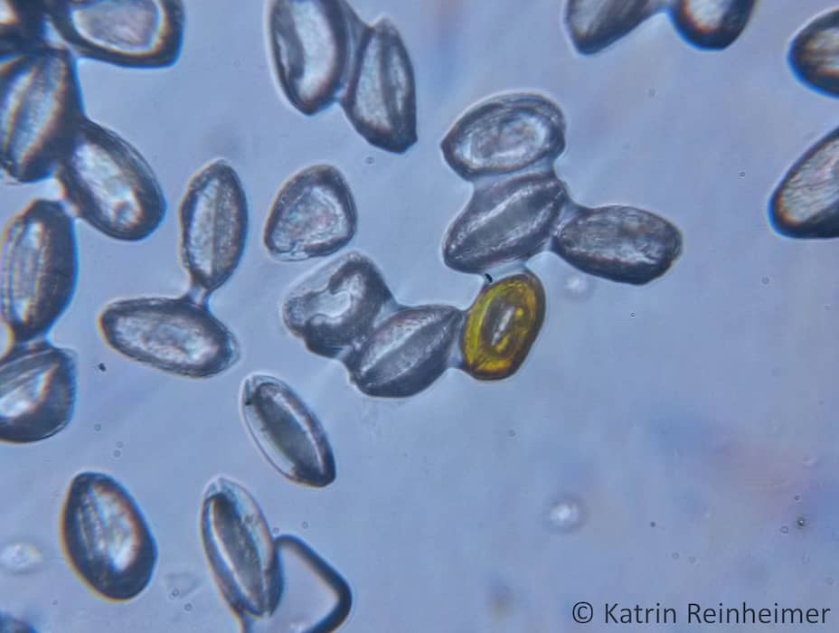 Schneeglöckchen-Pollen unter dem Mikroskop.