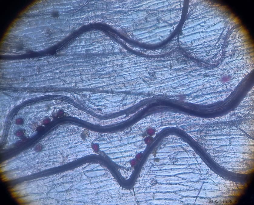 Die Kapillare unter dem Mikroskop.